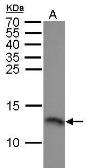 Anti-RPA14 antibody used in Western Blot (WB). GTX100088