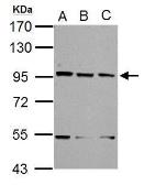 Anti-XAB2 antibody [N1N2], N-term used in Western Blot (WB). GTX100090