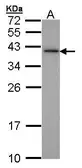 Anti-XLF antibody [N3C3] used in Western Blot (WB). GTX100092