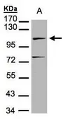 Anti-DNA ligase IV antibody [N2C2], Internal used in Western Blot (WB). GTX100100