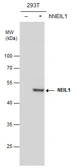 Anti-NEIL1 antibody [N1C1] used in Western Blot (WB). GTX100102