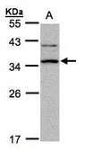 Anti-XRCC2 antibody [N1N3] used in Western Blot (WB). GTX100113