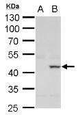 Anti-XRCC3 antibody [C1C3] used in Western Blot (WB). GTX100115