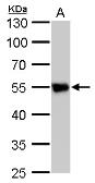 Anti-beta Tubulin 2 antibody used in Western Blot (WB). GTX100117