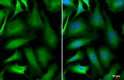 Anti-GAPDH antibody used in Immunocytochemistry/ Immunofluorescence (ICC/IF). GTX100118