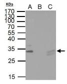 Anti-TIP30 antibody used in Immunoprecipitation (IP). GTX100119