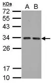 Anti-TIP30 antibody used in Western Blot (WB). GTX100119