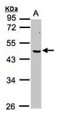 Anti-ERCC8 antibody used in Western Blot (WB). GTX100122
