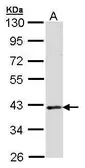 Anti-DMC1 antibody [N3C3] used in Western Blot (WB). GTX100131