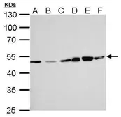 Anti-ERCC8 antibody [N2C2], Internal used in Western Blot (WB). GTX100145
