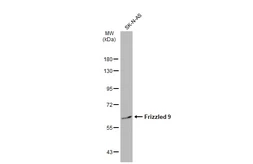 Anti-Frizzled 9 antibody [N1N2], N-term used in Western Blot (WB). GTX100169