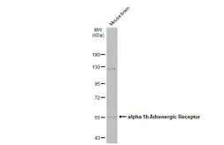 Anti-alpha 1b Adrenergic Receptor antibody used in Western Blot (WB). GTX100177