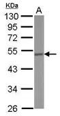 Anti-CRHR1 antibody [N1N2], N-term used in Western Blot (WB). GTX100180