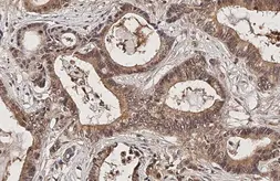 Anti-Frizzled 3 antibody used in IHC (Paraffin sections) (IHC-P). GTX100182