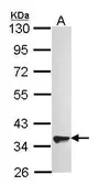Anti-GPR82 antibody [N2C1], Internal used in Western Blot (WB). GTX100196
