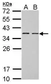 Anti-BCL7A antibody [C2C3], C-term used in Western Blot (WB). GTX100197