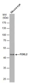 Anti-FOXL2 antibody [C3], C-term used in Western Blot (WB). GTX100200