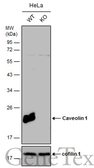 Anti-Caveolin 1 antibody [N1N3] used in Western Blot (WB). GTX100205