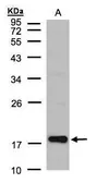 Anti-Cofilin 2 antibody used in Western Blot (WB). GTX100213