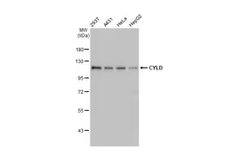 Anti-CYLD antibody used in Western Blot (WB). GTX100228