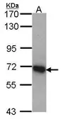Anti-DDX5 antibody [C3], C-term used in Western Blot (WB). GTX100234
