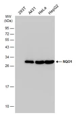 Anti-NQO1 antibody [C2C3], C-term used in Western Blot (WB). GTX100235