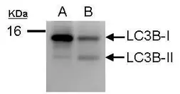 Anti-LC3B antibody used in Western Blot (WB). GTX100240