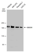 Anti-DOCK1 antibody used in Western Blot (WB). GTX100243