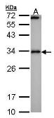 Anti-Calcipressin 1 antibody used in Western Blot (WB). GTX100245