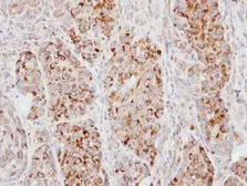 Anti-ECT2 antibody [N1], N-term used in IHC (Paraffin sections) (IHC-P). GTX100248