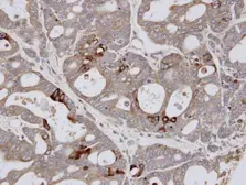 Anti-ESE1 antibody [C2C3], C-term used in IHC (Paraffin sections) (IHC-P). GTX100250