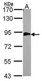 Anti-EML1 antibody [C3], C-term used in Western Blot (WB). GTX100252
