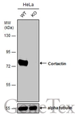Anti-Cortactin antibody [N1], N-term used in Western Blot (WB). GTX100253