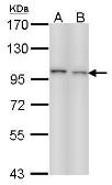 Anti-EPS8 antibody [C3], C-term used in Western Blot (WB). GTX100254