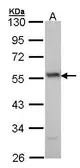 Anti-ERG antibody [C3], C-term used in Western Blot (WB). GTX100257