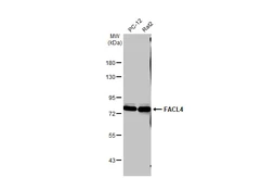 Anti-FACL4 antibody [C3], C-term used in Western Blot (WB). GTX100260