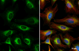 Anti-FACL4 antibody [C3], C-term used in Immunocytochemistry/ Immunofluorescence (ICC/IF). GTX100260