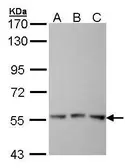 Anti-FGR antibody [C3], C-term used in Western Blot (WB). GTX100265