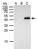 Anti-FOXE1 antibody used in Immunoprecipitation (IP). GTX100275