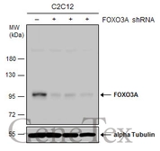 Anti-FOXO3A antibody [C3], C-term used in Western Blot (WB). GTX100277