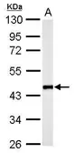 Anti-Flotillin 2 antibody [C3], C-term used in Western Blot (WB). GTX100279