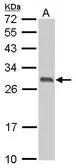 Anti-14-3-3 sigma antibody used in Western Blot (WB). GTX100289