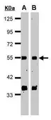 Anti-CSN1 antibody [C3], C-term used in Western Blot (WB). GTX100291