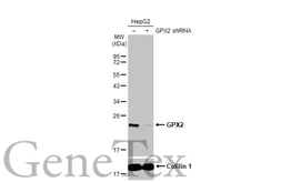 Anti-GPX2 antibody [C1C3] used in Western Blot (WB). GTX100292