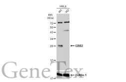 Anti-GRB2 antibody used in Western Blot (WB). GTX100294