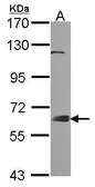 Anti-GRB7 antibody [N1], N-term used in Western Blot (WB). GTX100296