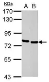 Anti-HCLS1 antibody [C3], C-term used in Western Blot (WB). GTX100303