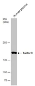 Anti-Factor H antibody [N3C1], Internal used in Western Blot (WB). GTX100305