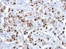 Anti-FOXA1 antibody used in IHC (Paraffin sections) (IHC-P). GTX100308