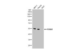 Anti-FOXA1 antibody used in Western Blot (WB). GTX100308